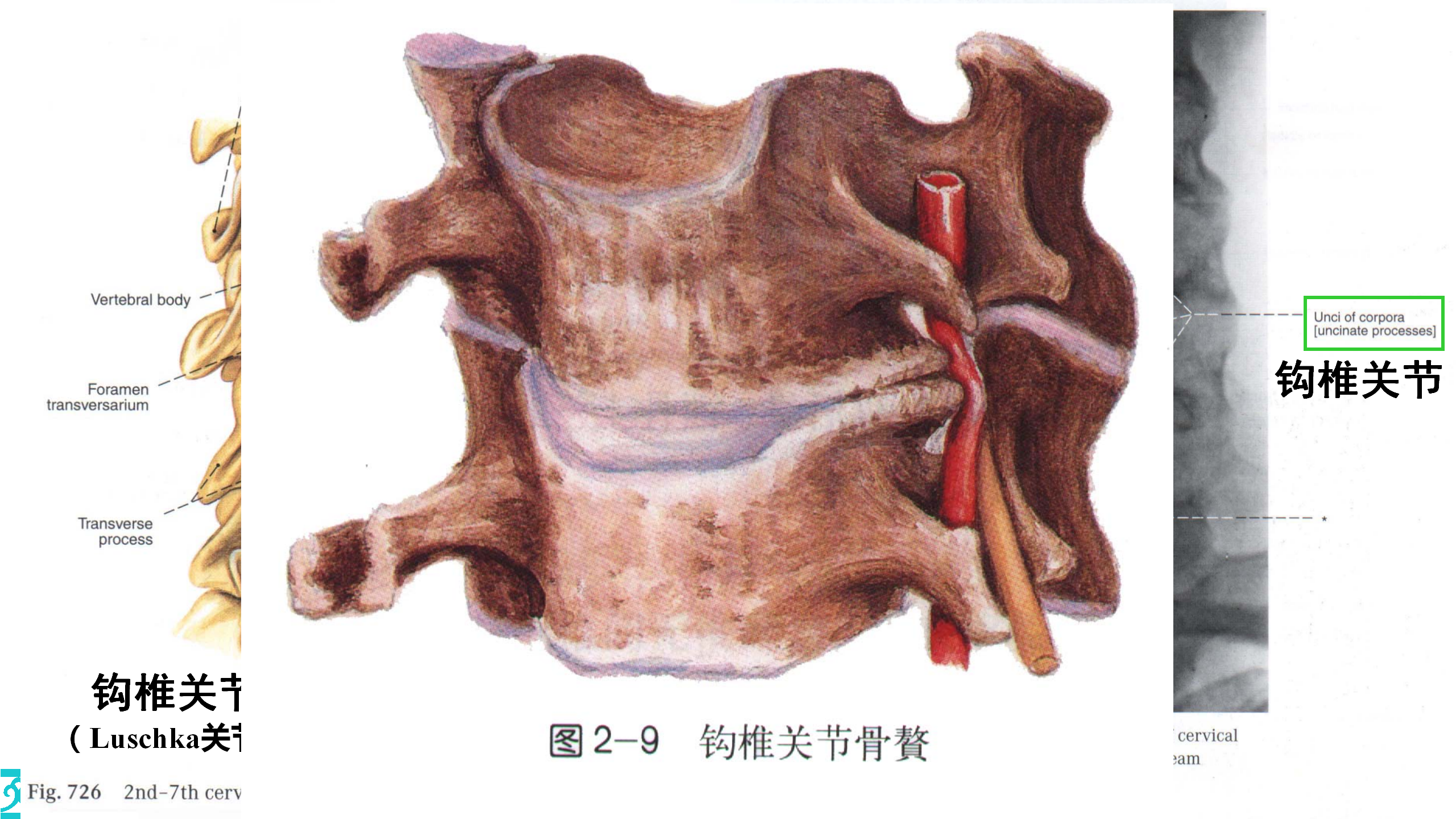颈部解剖_16.png